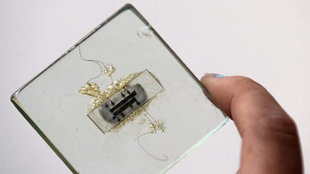 implanteerbare chip
